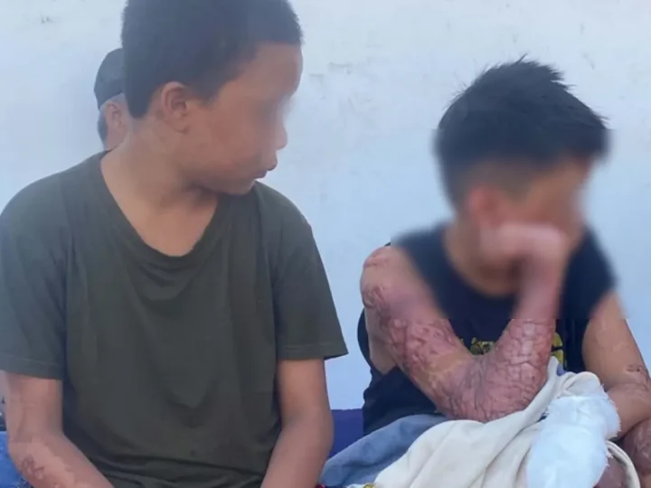 Polda NTB Ambil Alih Kasus Santri Terbakar, Dua Tersangka Diproses