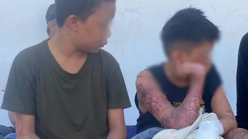 Polda NTB Ambil Alih Kasus Santri Terbakar, Dua Tersangka Diproses