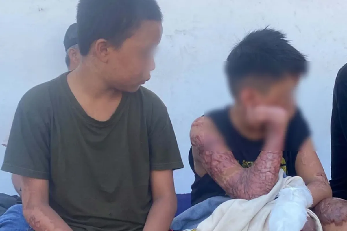 Polda NTB Ambil Alih Kasus Santri Terbakar, Dua Tersangka Diproses